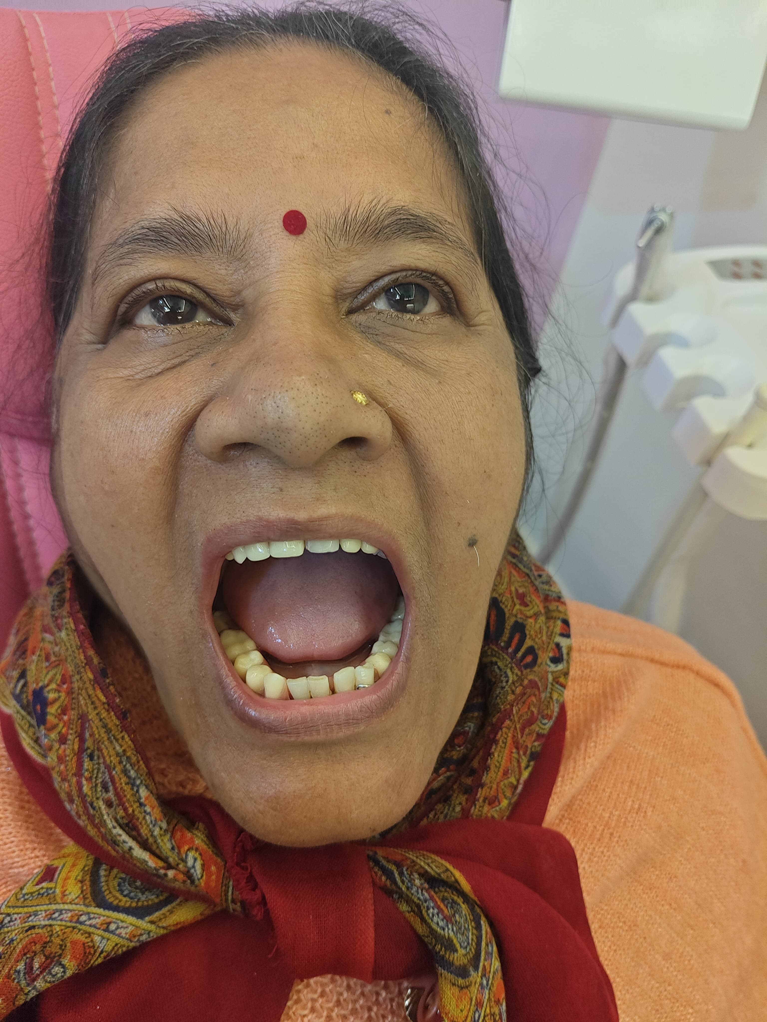 Smile Transformation Case 8